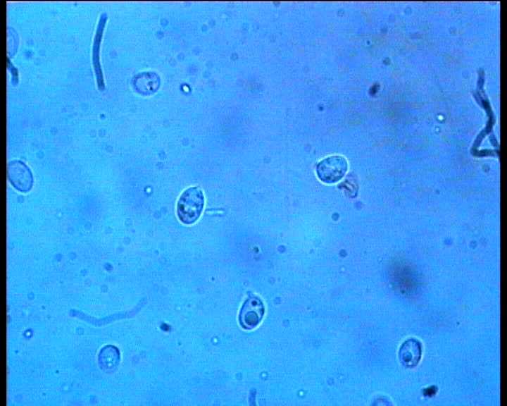Hydropus marginellus   (Pers.:Fr.)  Singer